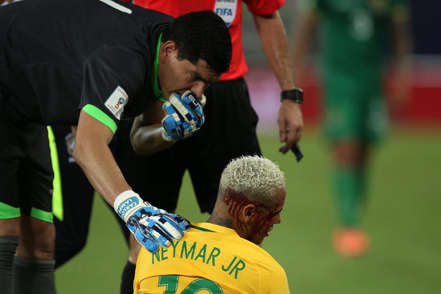 Neymar dostał z "łokcia" i zalał się krwią. Gwiazdor musiał opuścić boisko